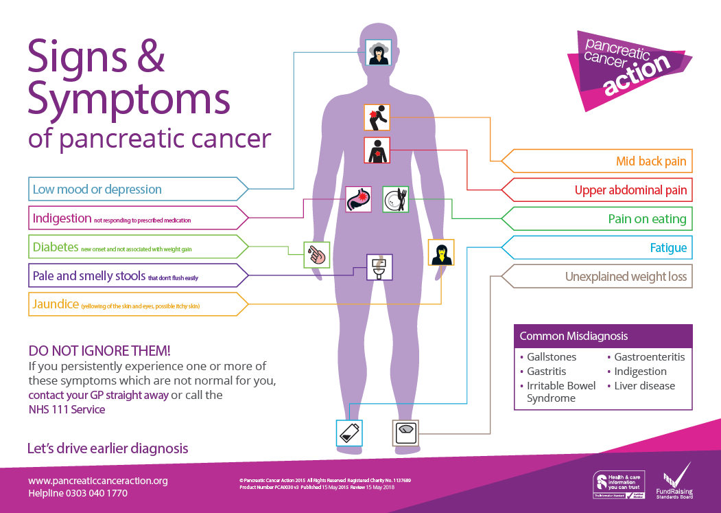 Signs And Symptoms Of Pancreatic Cancer — Info You Should Know