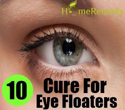 Eye Floaters Cure Naturally