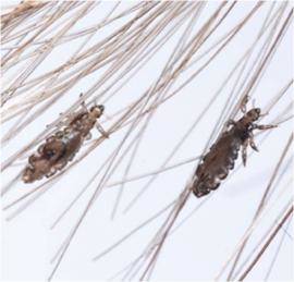 How to Prevent Head Lice — Info You Should Know